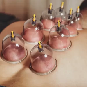 Full Body Cupping