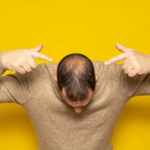 hair patch