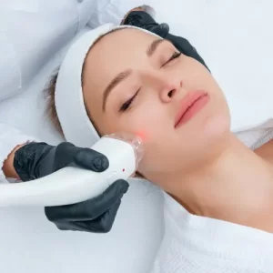 leser- treatment