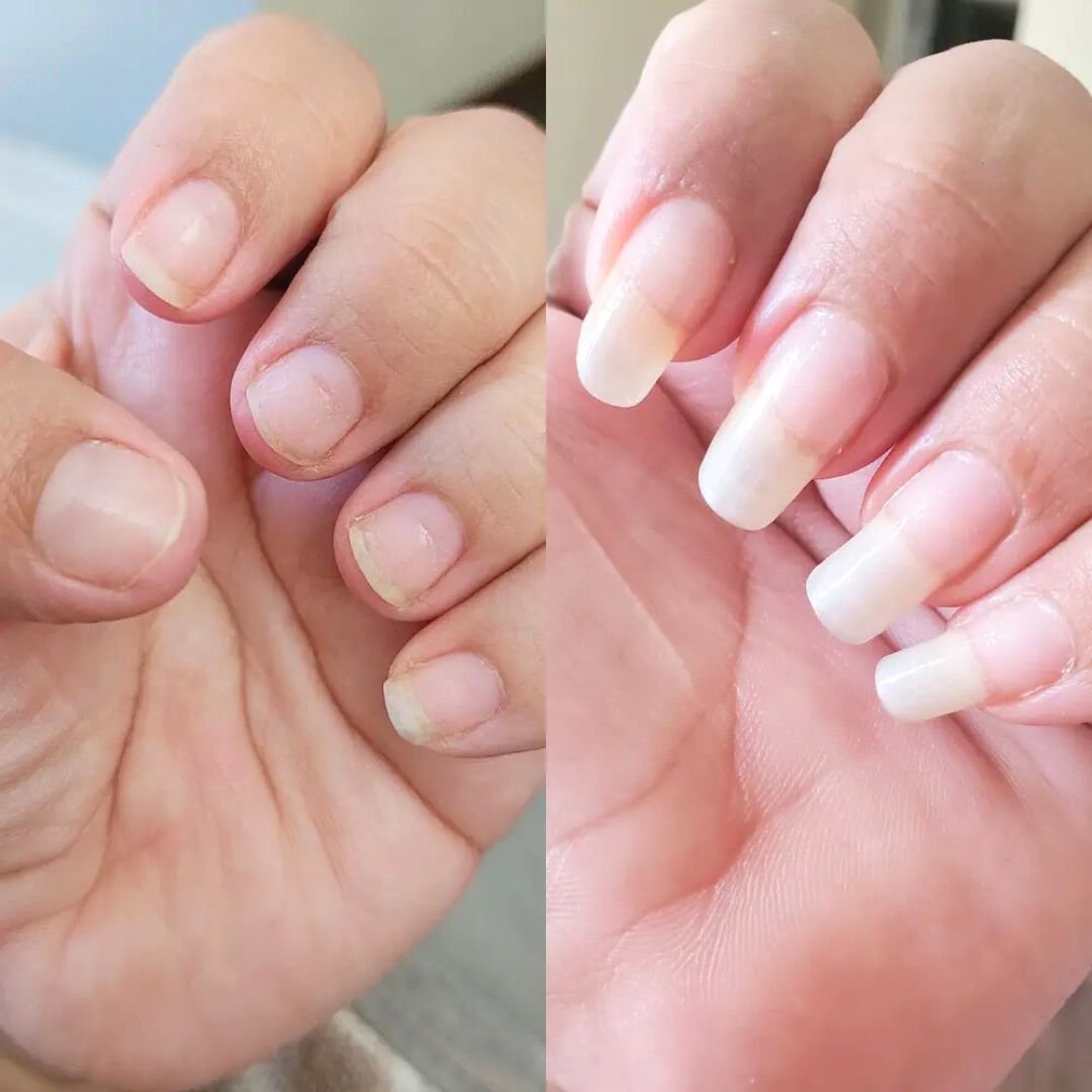 Best Nail Growth Tips