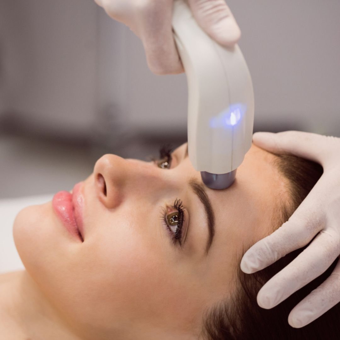Is A Carbon Facial Your Best Option?
