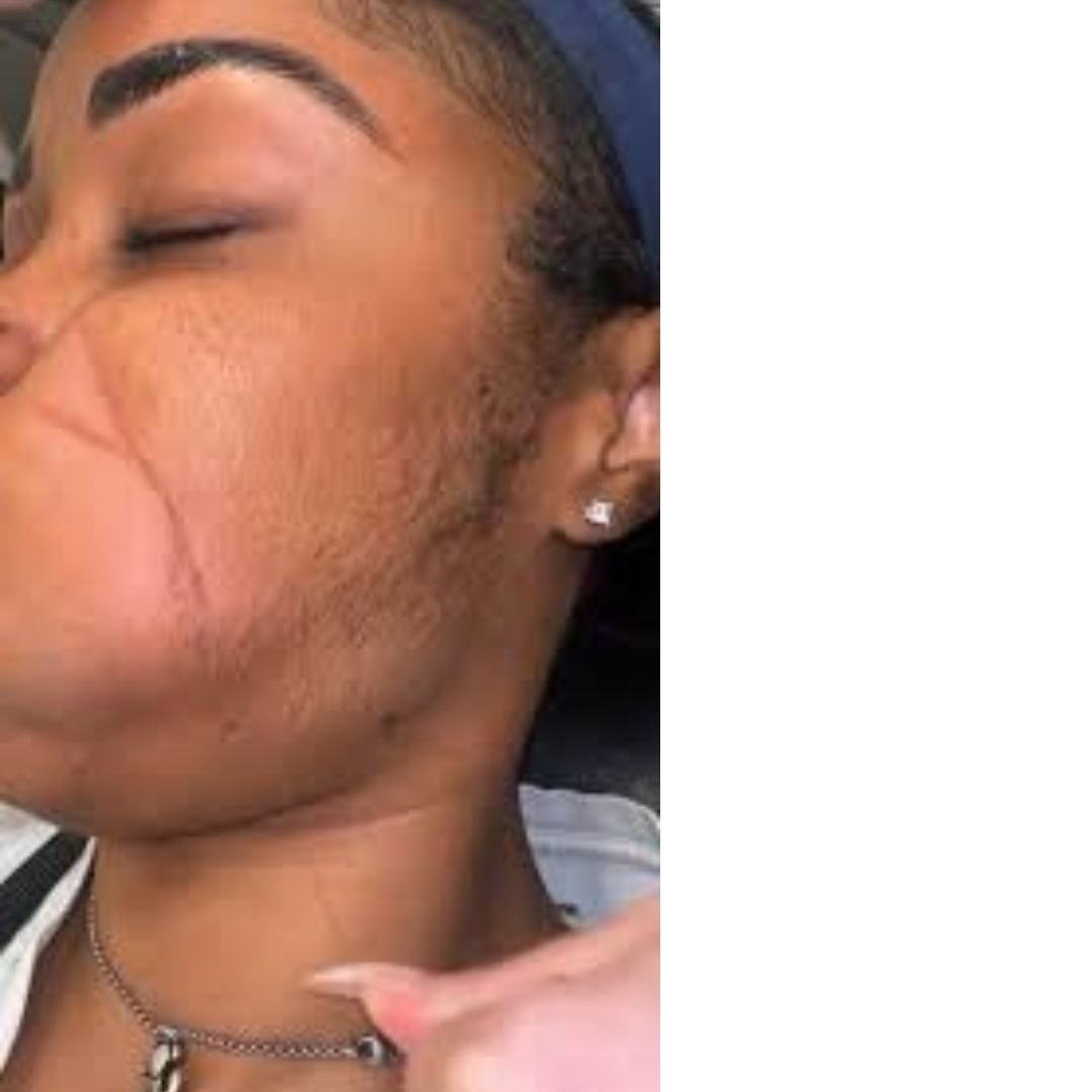 Best Guidance For Face Threading