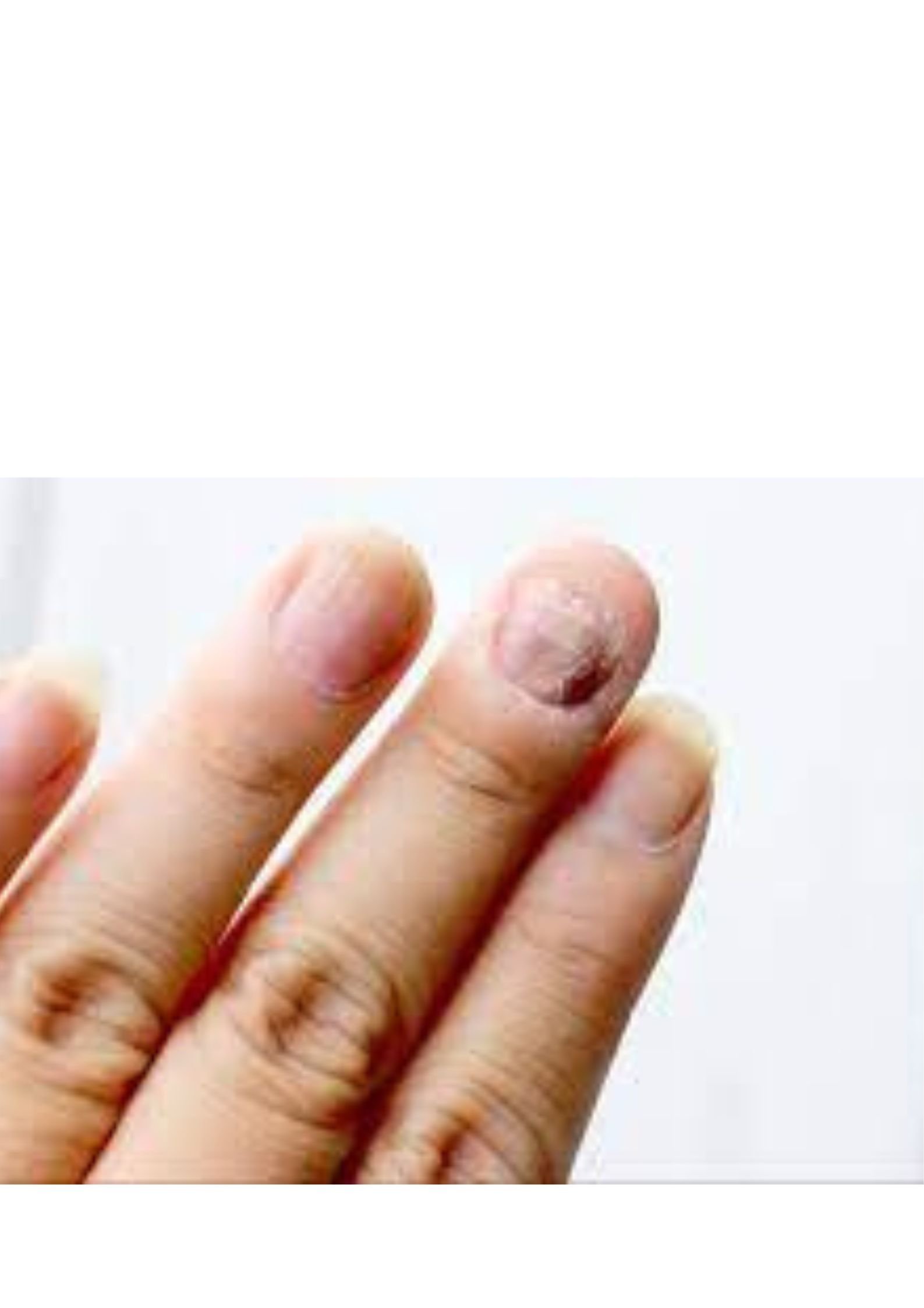 হতে পারে মারাত্মক অঘটন!