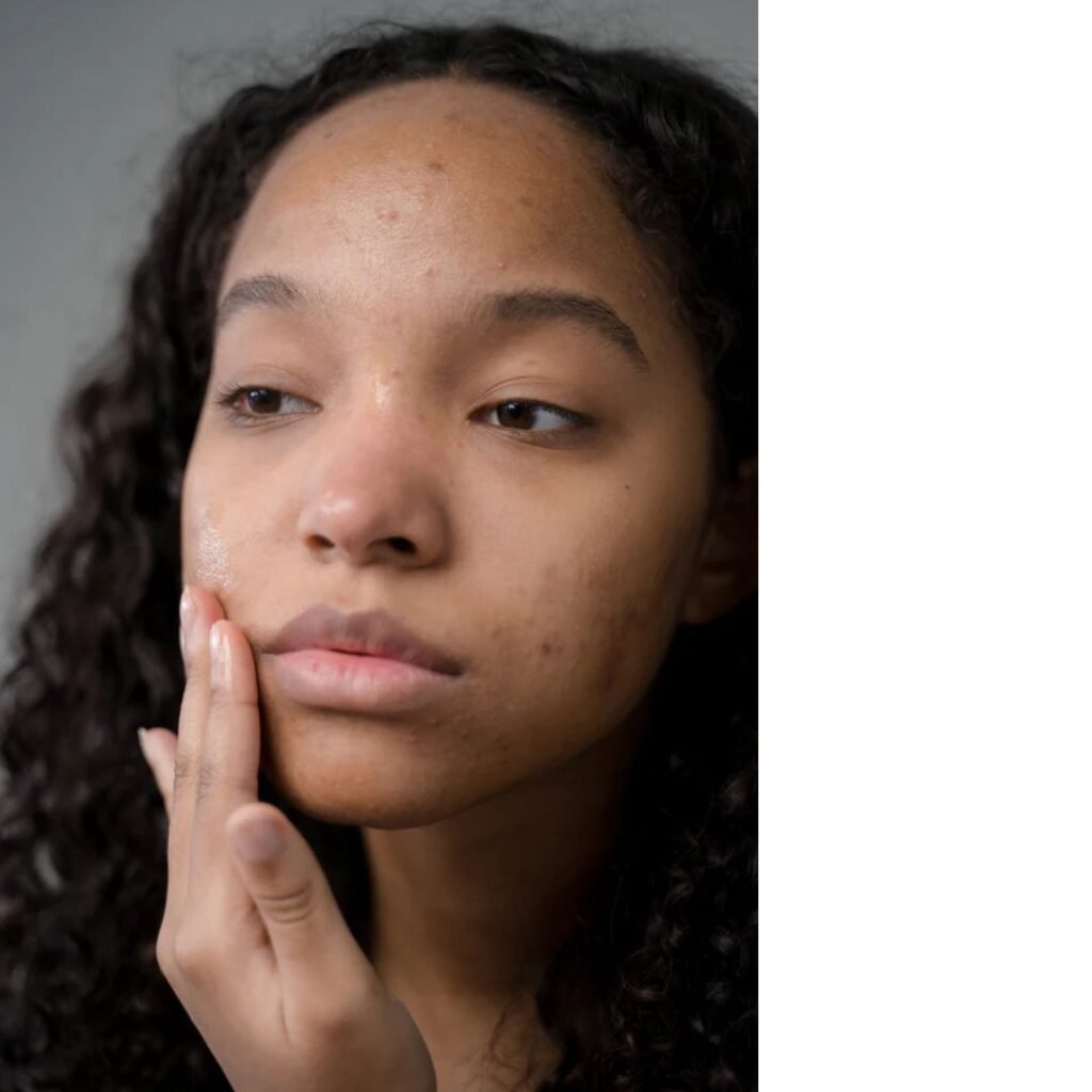 Is It Safe for All Skin Types?